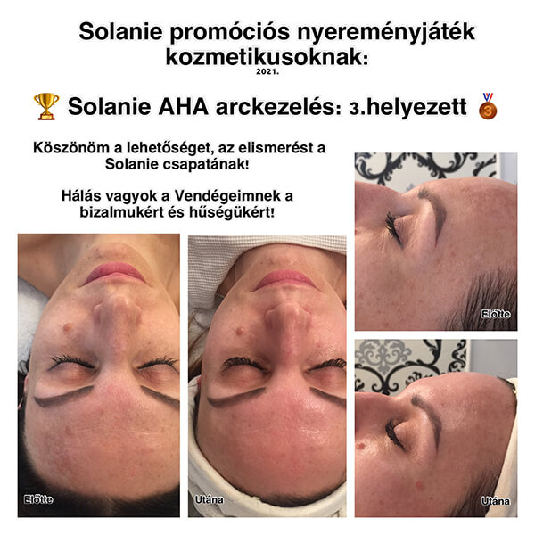 7.kerület Solanie arckezelés kozmetika Budapest